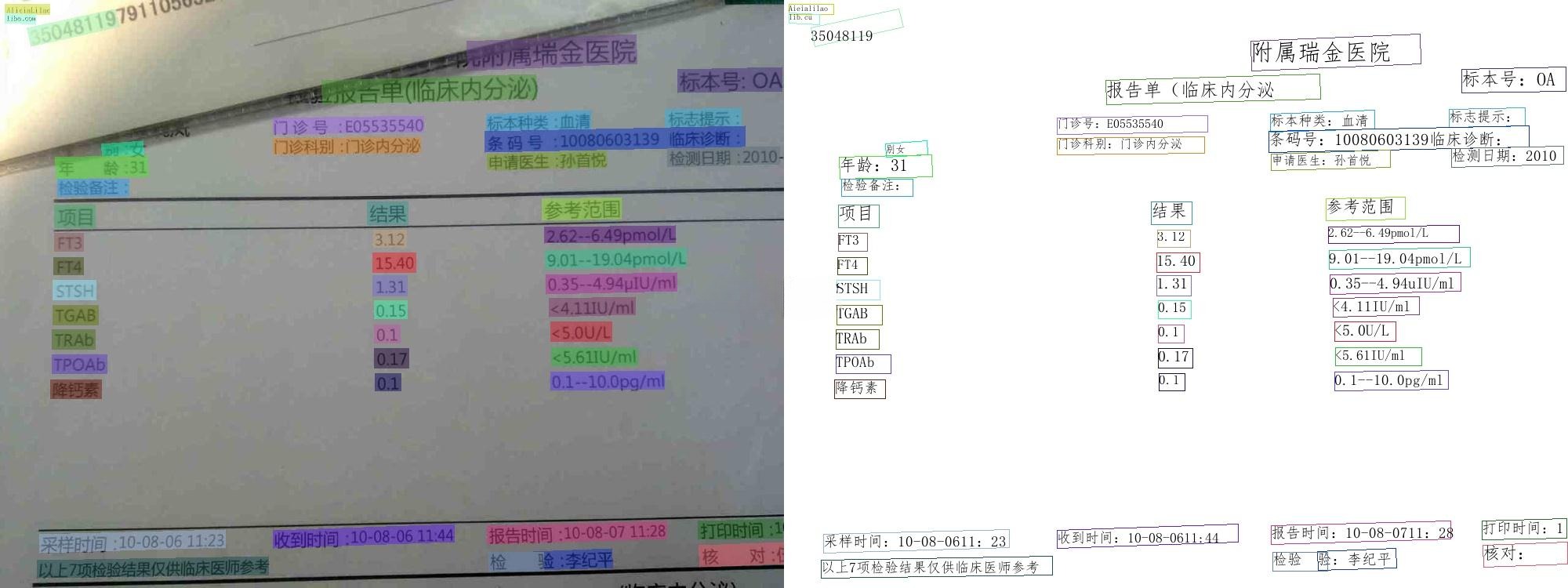 PaddleOCR 2025智能文字识别系统源码